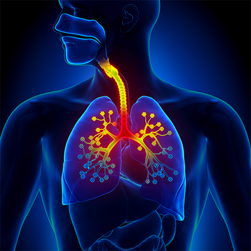 Bronchial Asthma