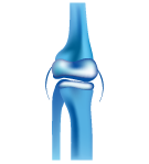 Orthopaedics & Joint Replacement